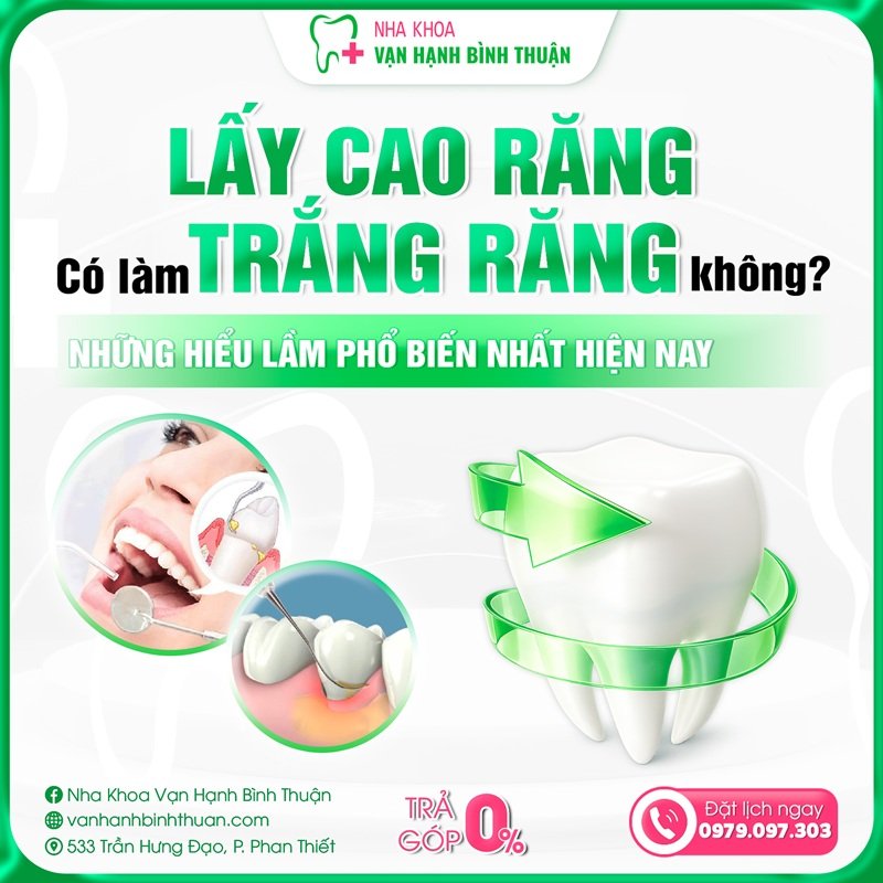 Lấy cao răng có làm trắng răng không? Những hiểu lầm phổ biến nhất hiện nay